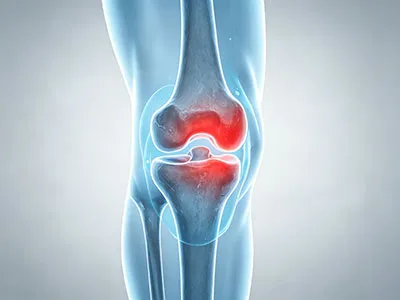 Global Joint Health Market Booms: Innovative Raw Materials Empower Manufacturers to Tap Into Sports Nutrition Growth Opportunities